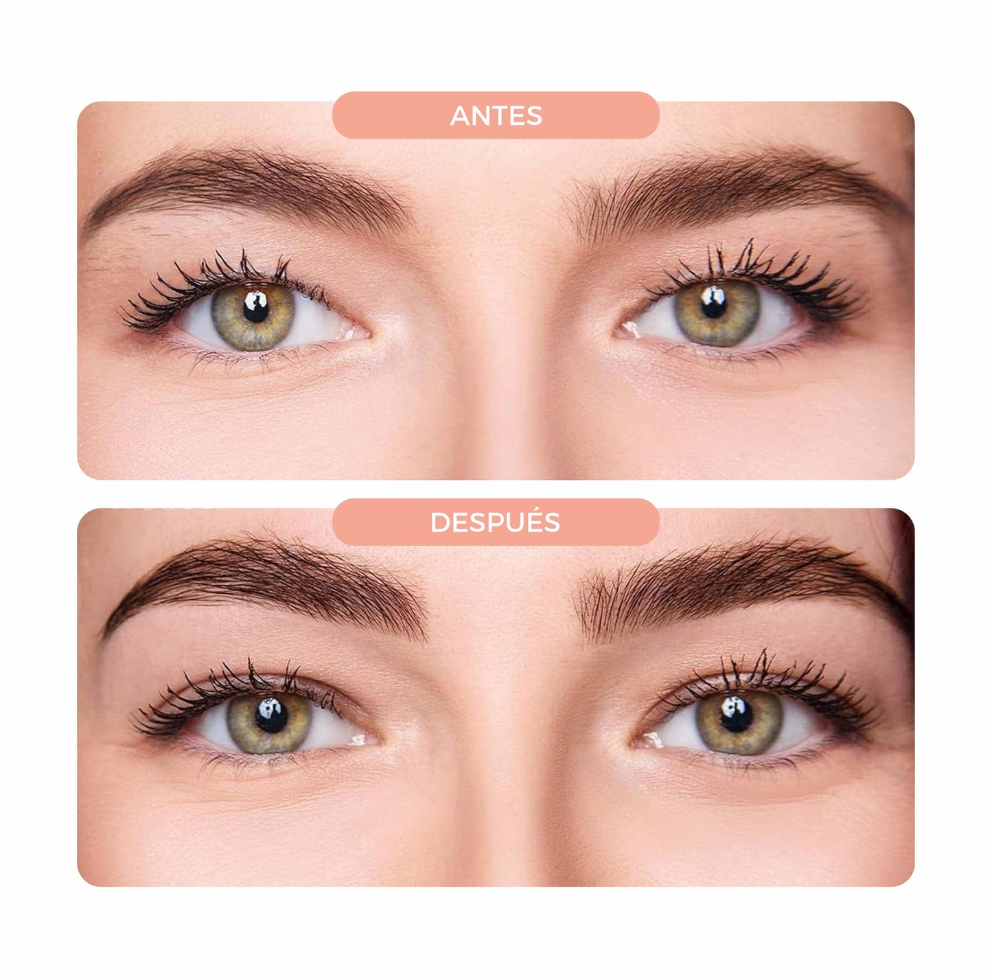 240x1 | Kit Levanta Párpados Caídos - EyeLift©