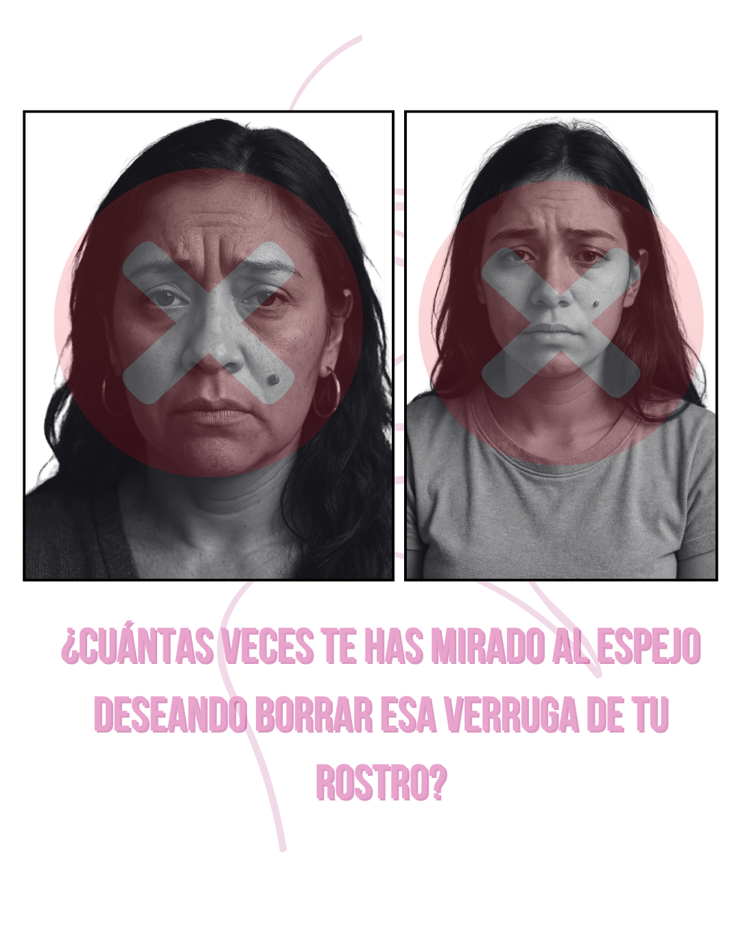 LUMINIIX - ADIÓS VERRUGAS - Adquira 1 Lleve 2